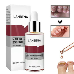 SERUM  ANTI HONGOS